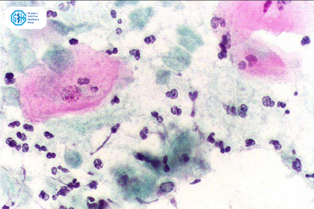 trichomonas vaginalis dưới kính hiển vi