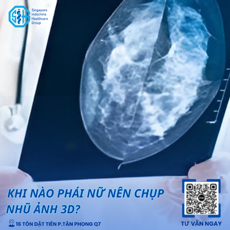 👙Khi nào phái đẹp nên chụp nhũ ảnh 3D?