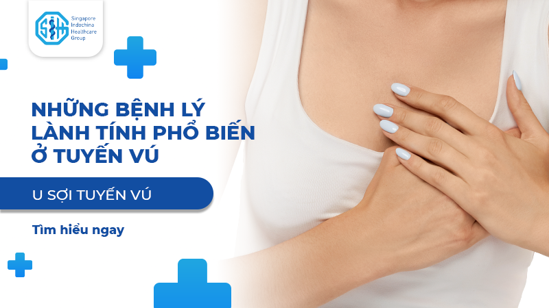U SỢI TUYẾN VÚ - BỆNH LÝ LÀNH TÍNH PHỔ BIẾN Ở TUYẾN VÚ