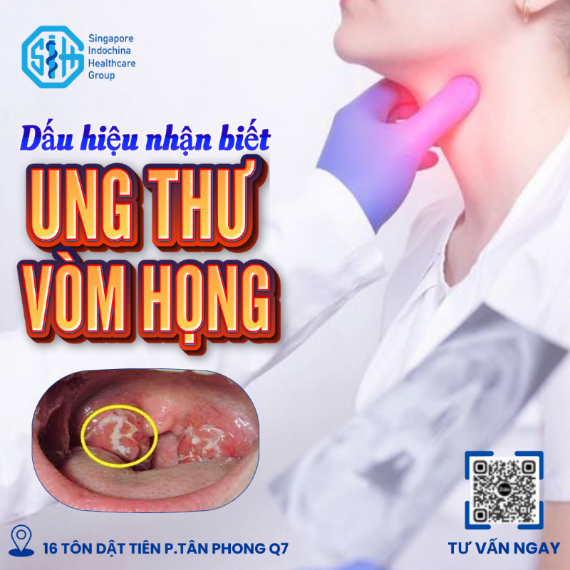 Điểm mặt 6 triệu chứng nguy cơ gây Ung thư vòm họng