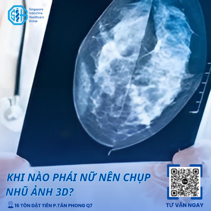 Khi nào phái đẹp nên chụp nhũ ảnh 3D?