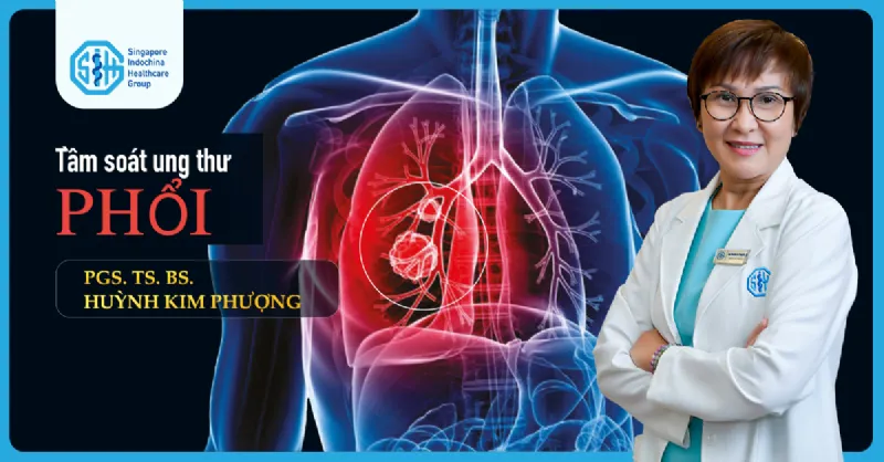 Tầm soát ung thư phổi