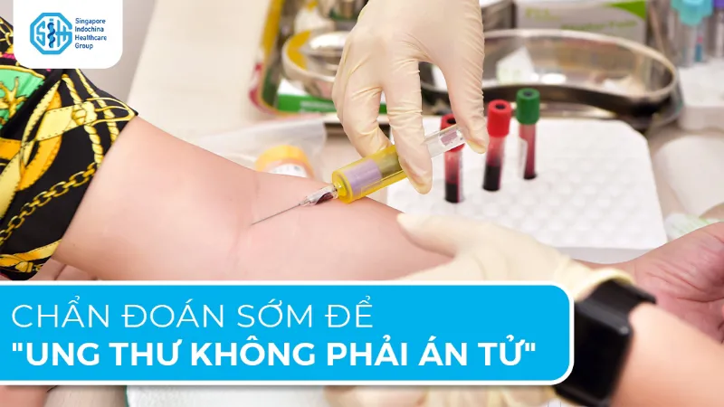 CHẨN ĐOÁN SỚM ĐỂ UNG THƯ KHÔNG PHẢI ÁN TỬ