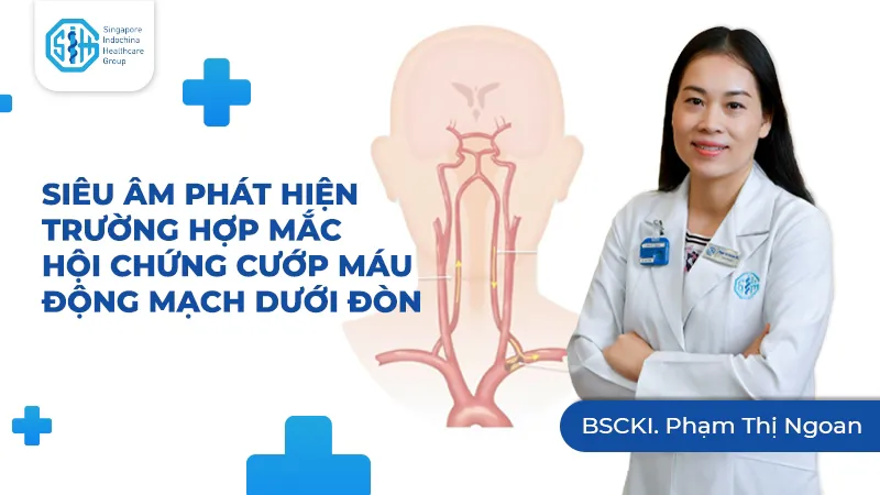 SIÊU ÂM PHÁT HIỆN TRƯỜNG HỢP MẮC HỘI CHỨNG CƯỚP MÁU ĐỘNG MẠCH DƯỚI ĐÒN (SUBCLAVIAN STEAL SYNDROME -SSS)