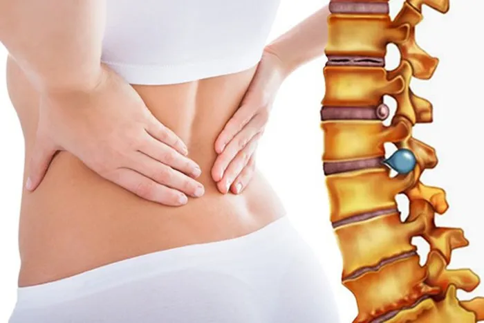 Thoát vị đĩa đệm ở người trẻ tuổi