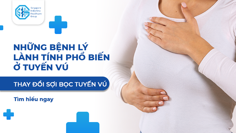 THAY ĐỔI SỢI BỌC TUYẾN VÚ - BỆNH LÝ LÀNH TÍNH PHỔ BIẾN Ở TUYẾN VÚ