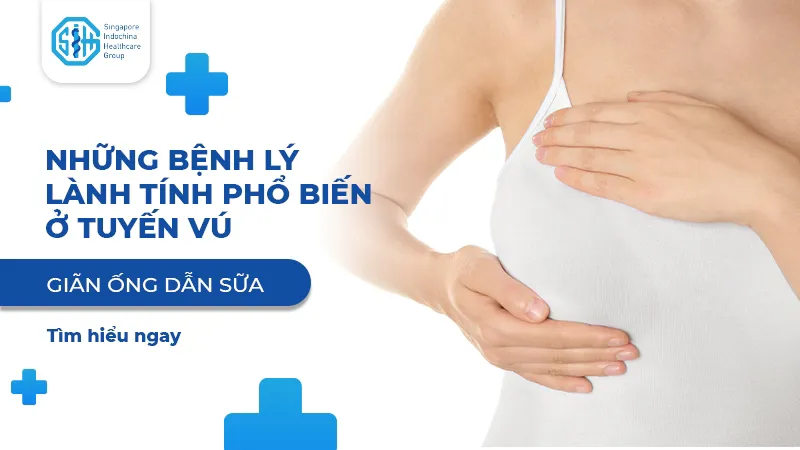 GIÃN ỐNG DẪN SỮA - BỆNH LÝ LÀNH TÍNH PHỔ BIẾN Ở TUYẾN VÚ
