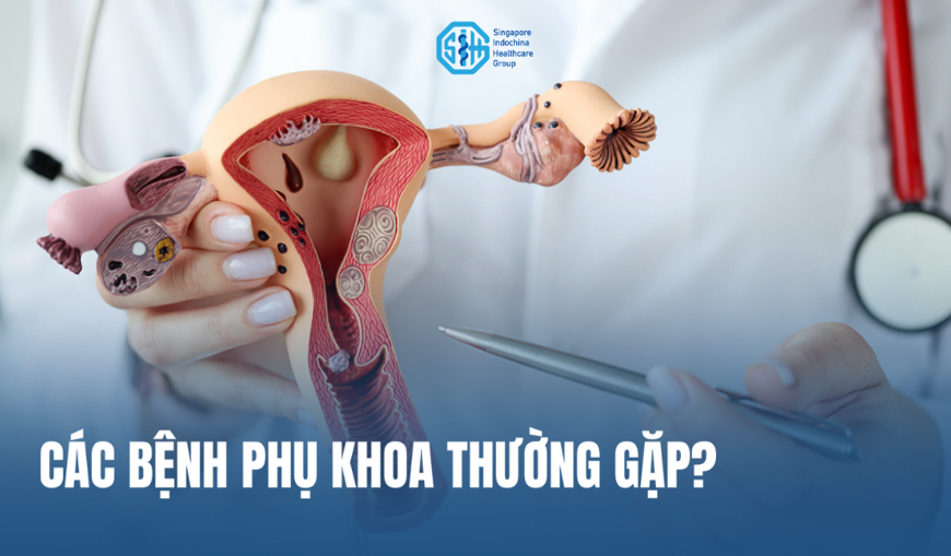 Các bệnh phụ khoa thường gặp ở phụ nữ và mức độ nguy hiểm