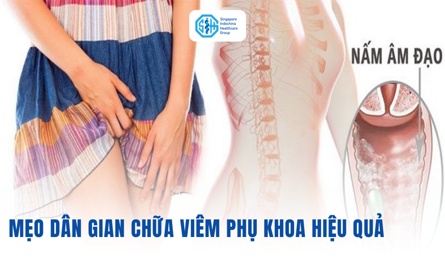 Mẹo dân gian chữa viêm phụ khoa: Hiệu quả và lưu ý