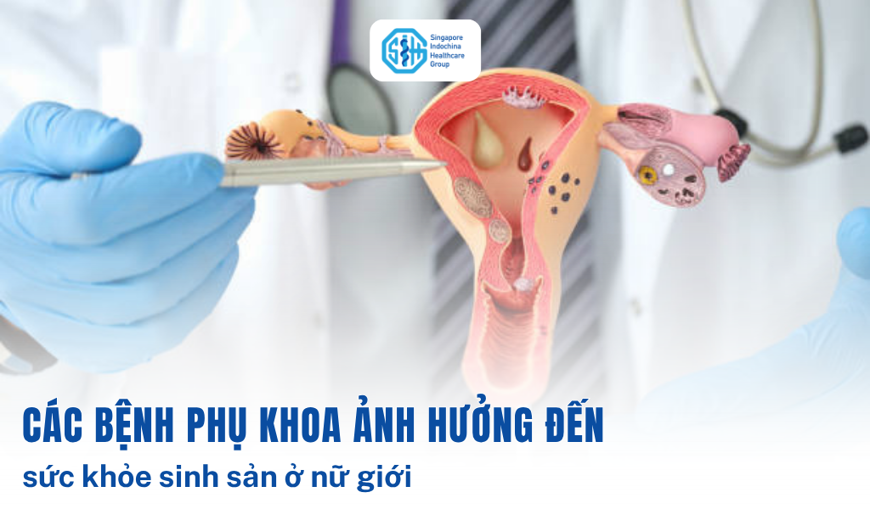 Các bệnh phụ khoa ảnh hưởng đến sức khỏe sinh sản ở nữ giới