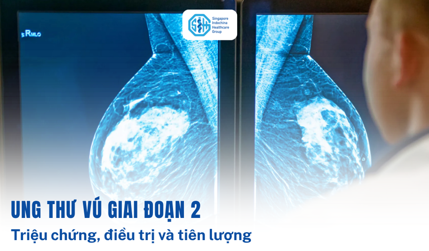 Ung thư vú giai đoạn 2: Triệu chứng, điều trị & tiên lượng
