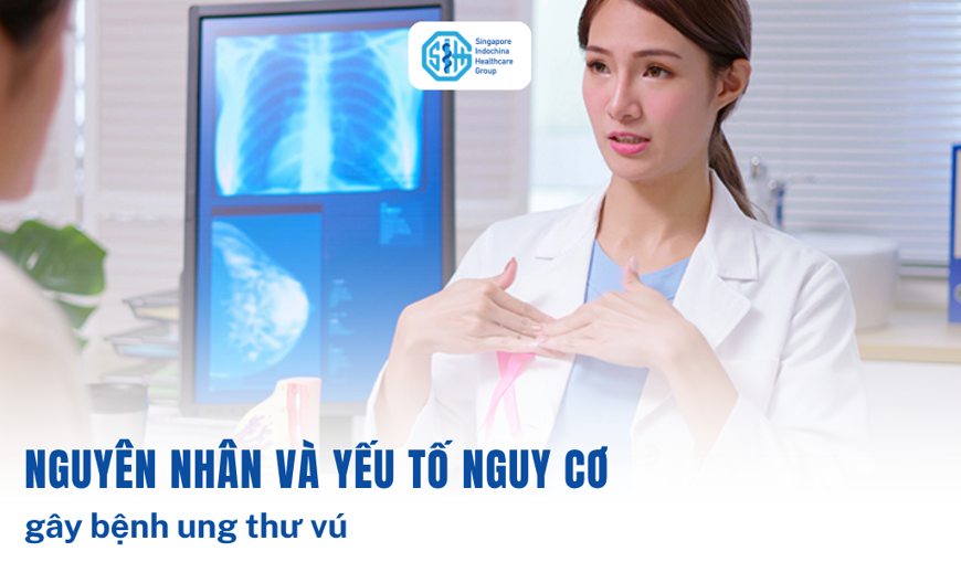 Nguyên nhân & yếu tố nguy cơ gây ung thư vú