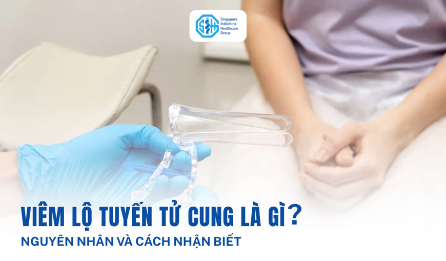 Viêm lộ tuyến cổ tử cung là gì? Nguyên nhân và dấu hiệu nhận biết