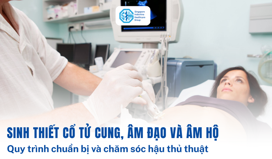 Những điều cần biết về sinh thiết cổ tử cung, âm hộ & âm đạo