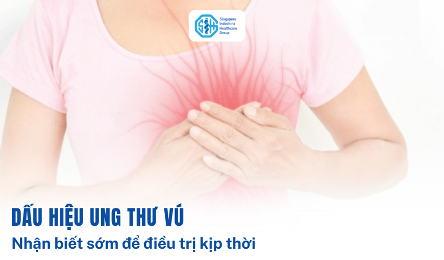 09 dấu hiệu ung thư vú giai đoạn đầu thường bị bỏ qua