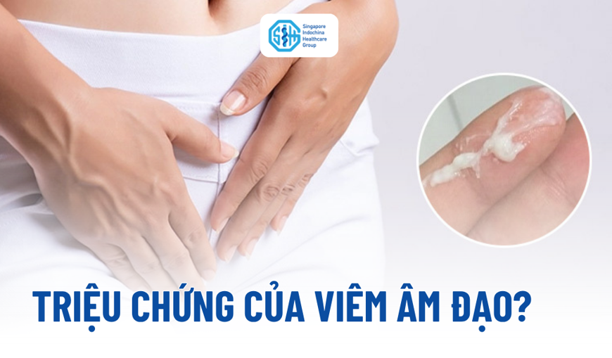 06 Triệu chứng viêm âm đạo giúp nhận biết sớm bạn không nên bỏ qua