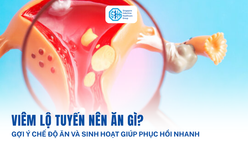 Viêm lộ tuyến nên ăn gì? Gợi ý chế độ ăn và sinh hoạt giúp phục hồi nhanh
