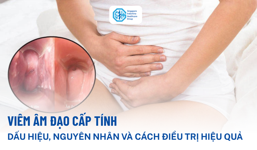 Viêm âm đạo cấp tính: Dấu hiệu, nguyên nhân và cách điều trị hiệu quả