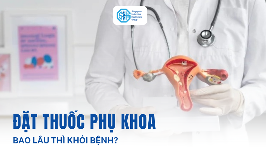 Đặt thuốc phụ khoa bao lâu thì khỏi? Hiệu quả điều trị viêm cổ tử cung