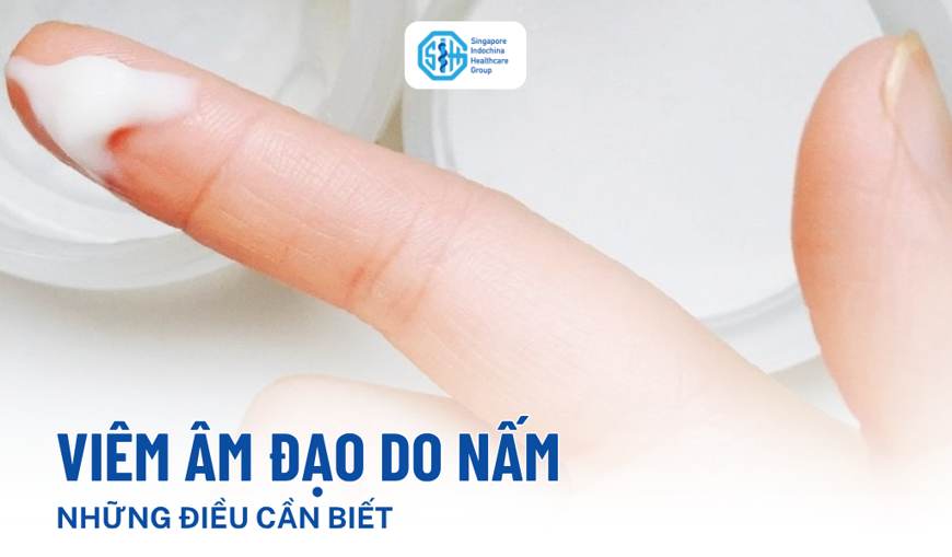 Viêm âm đạo do nấm: Dấu hiệu nhận biết, nguyên nhân và khi nào nên khám phụ khoa