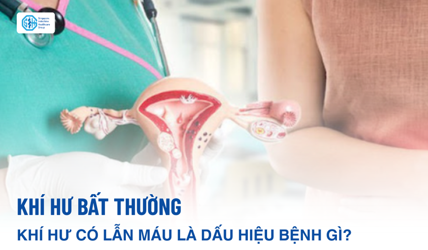 Khí hư bất thường: Khí hư có lẫn máu là dấu hiệu bệnh gì?