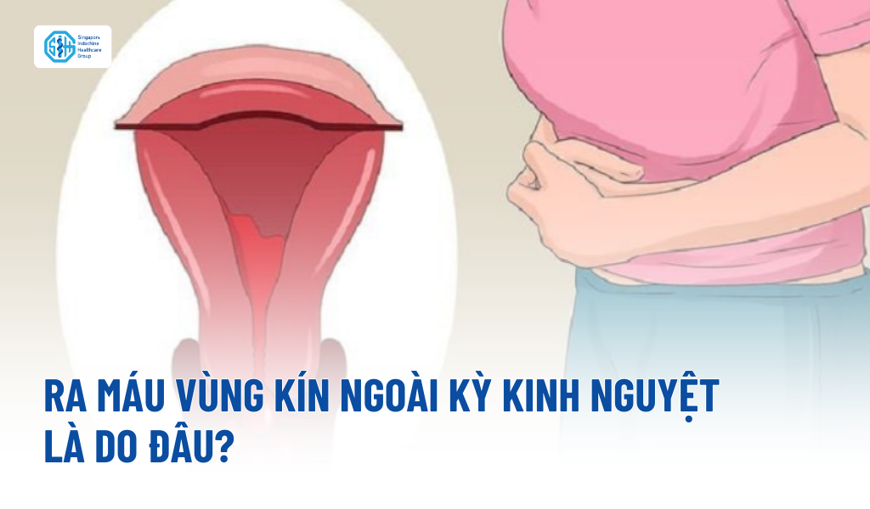 Ra máu ngoài kỳ kinh: Nguyên nhân, mức độ nguy hiểm và cách xử lý