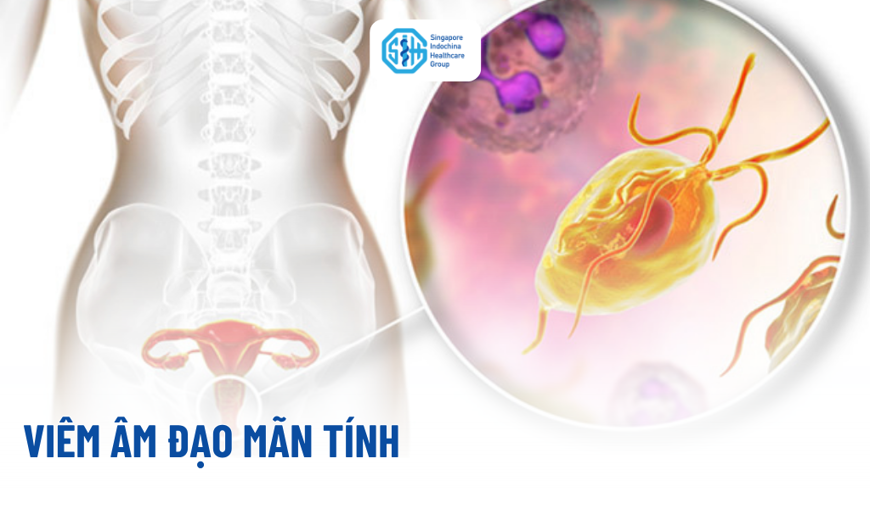 Viêm âm đạo mãn tính Nguyên nhân, dấu hiệu và cách điều trị hiệu quả