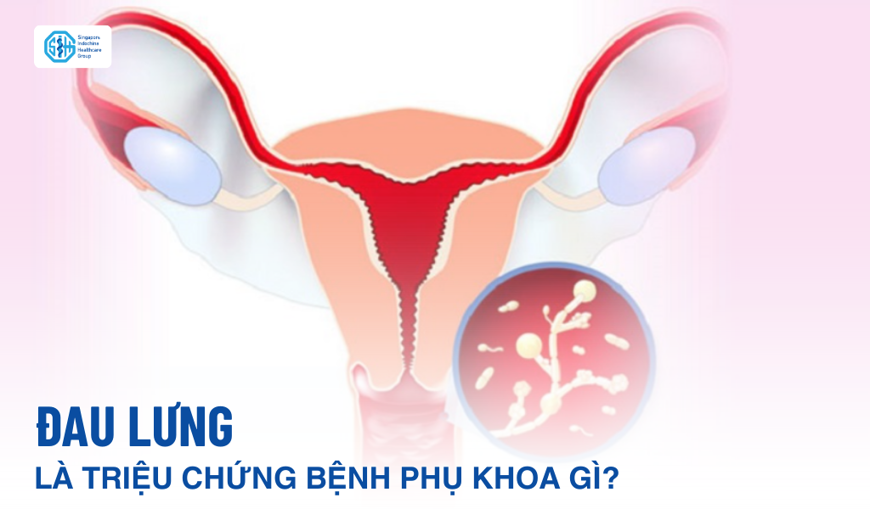 Những bệnh phụ khoa nào gây đau lưng ở phụ nữ?