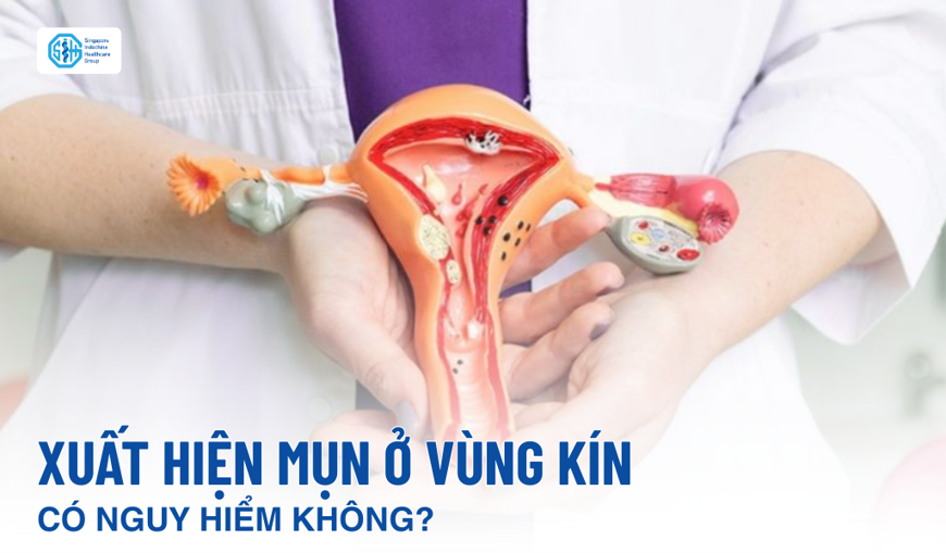 Xuất hiện mụn nước ở vùng kín có nguy hiểm không?