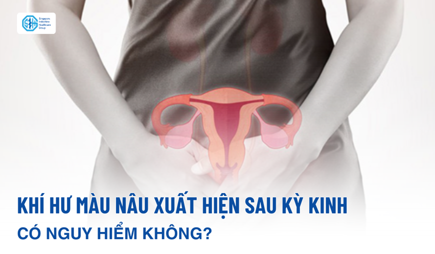 Khí hư màu nâu xuất hiện sau kỳ kinh có nguy hiểm không?