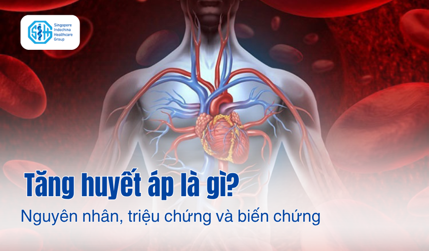Tăng huyết áp là gì? Nguyên nhân, triệu chứng và biến chứng