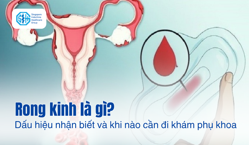 Rong kinh là gì? Dấu hiệu nhận biết và khi nào cần đi khám phụ khoa