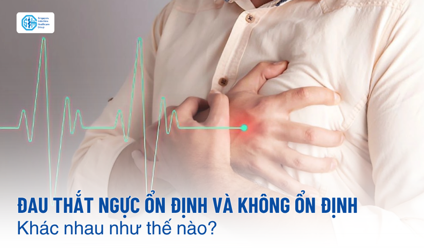 Đau thắt ngực ổn định và không ổn định khác biệt thế nào?