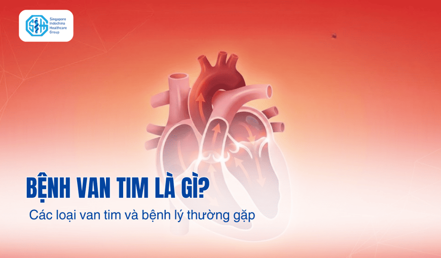 Bệnh van tim là gì? Các loại van và bệnh lý thường gặp