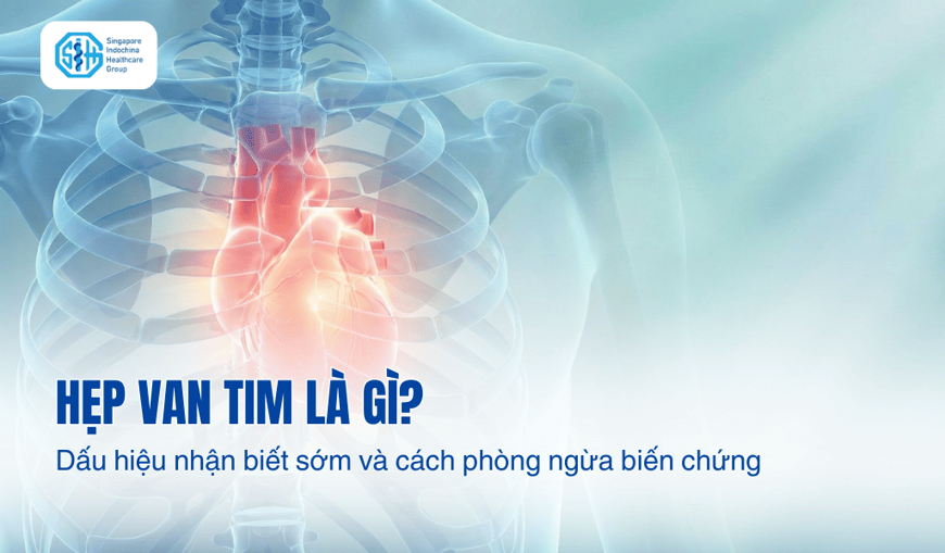 Hẹp van tim là gì? Dấu hiệu nhận biết sớm và cách phòng ngừa biến chứng