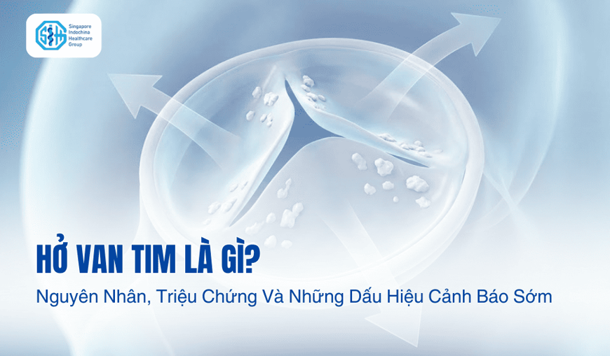Hở Van Tim Là Gì? Nguyên Nhân, Triệu Chứng Và Những Dấu Hiệu Cảnh Báo Sớm