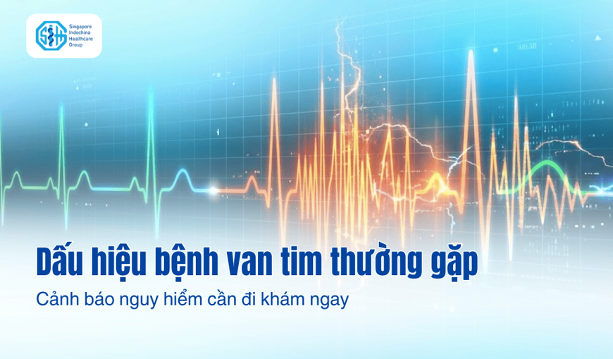 Dấu hiệu bệnh van tim thường gặp: Cảnh báo nguy hiểm cần đi khám ngay