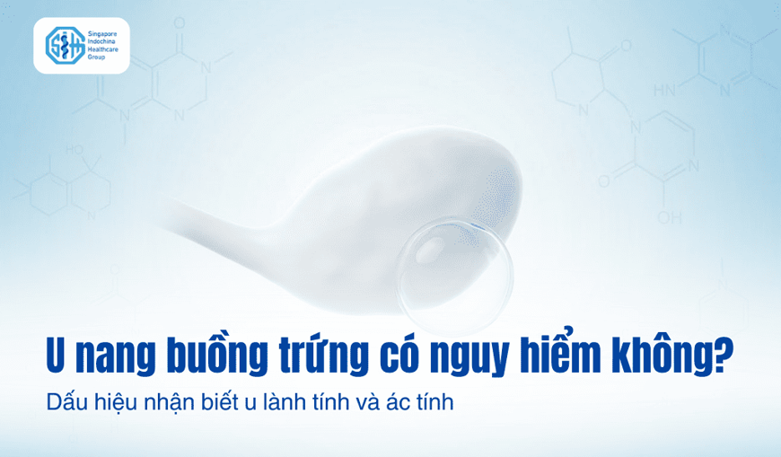 U nang buồng trứng có nguy hiểm không? Dấu hiệu nhận biết u lành tính và ác tính
