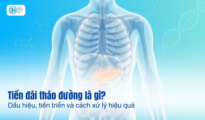 Tiền đái tháo đường là gì: Dấu hiệu, tiến triển và cách xử lý hiệu quả