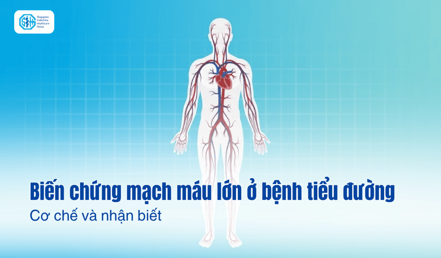 Biến chứng mạch máu lớn ở bệnh nhân tiểu đường: Cơ chế và nhận biết