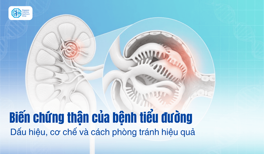 Biến chứng thận của bệnh tiểu đường: Dấu hiệu, cơ chế và cách phòng tránh hiệu quả
