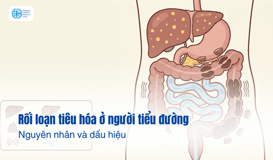 Rối loạn tiêu hóa ở người tiểu đường: Dấu hiệu cần biết