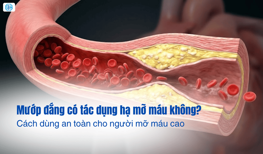 Mướp đắng có tác dụng hạ mỡ máu không? Cách dùng an toàn cho người mỡ máu cao